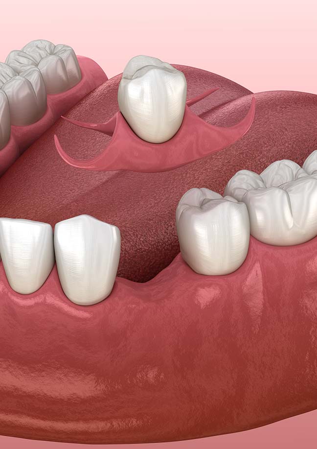 Treatment - Bullsmoor Dental & Aesthetics Clinic