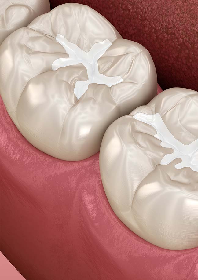 Treatment - Bullsmoor Dental & Aesthetics Clinic