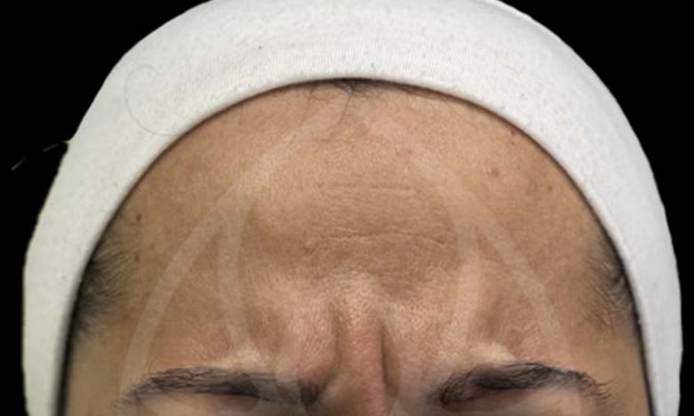 Before - Bullsmoor Dental