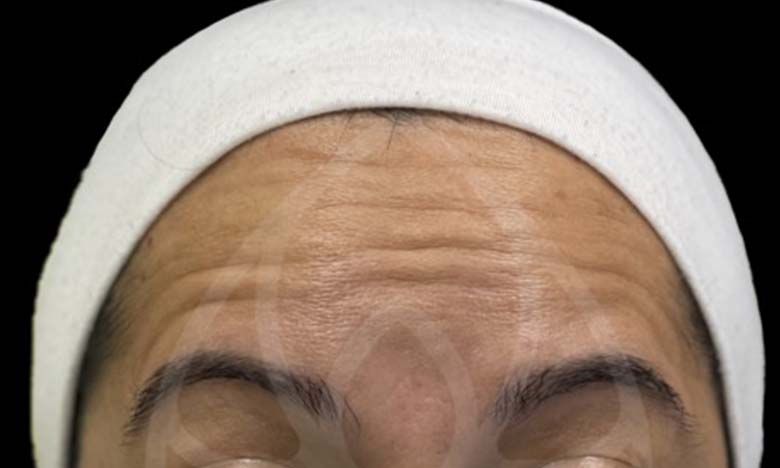 Before - Bullsmoor Dental