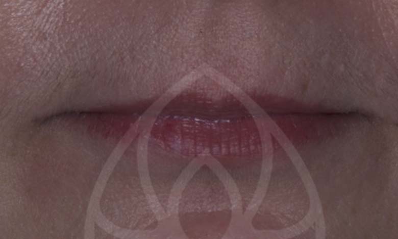 Before - Bullsmoor Dental