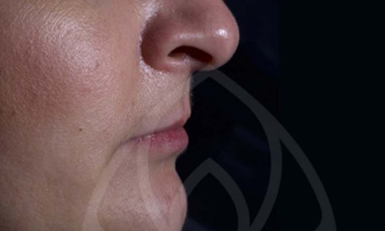 Before - Bullsmoor Dental